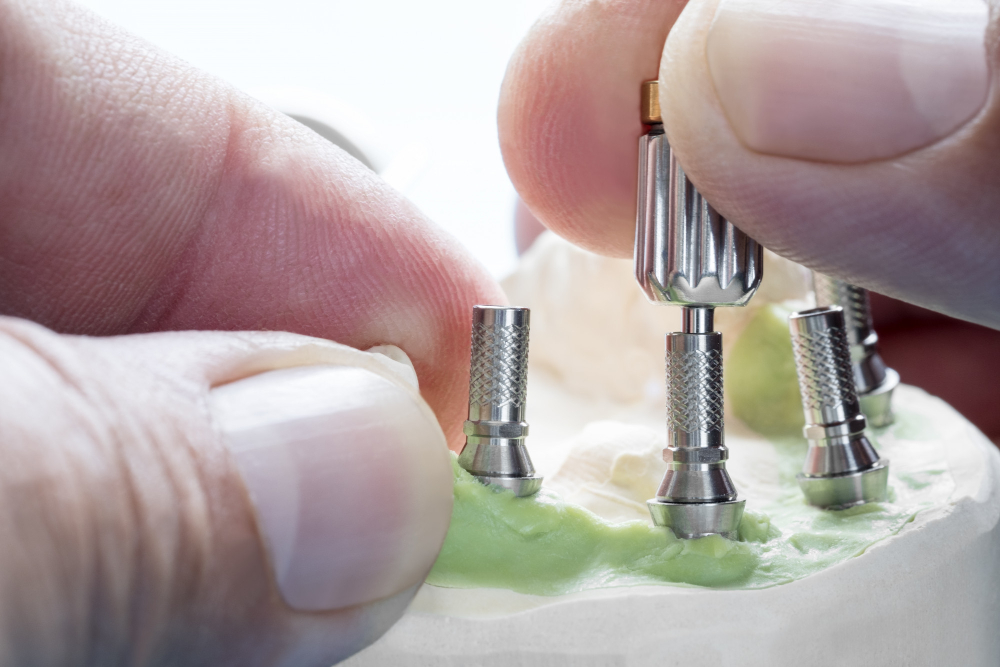 peri implant mucositis